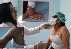 İnternetten sipariş verdiği krem hastanelik etti