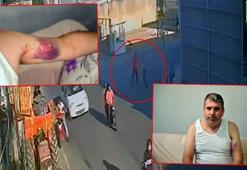 Miras anlaşmazlığı yaşadığı yeğenini, beyzbol sopasıyla dövdü