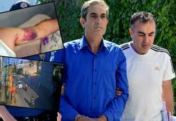 Miras anlaşmazlığında yeğenini beyzbol sopasıyla darbeden dayı: Beni tahrik etti, dayanamadım