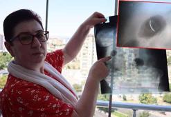 22 yıldır karnında ameliyat iğnesiyle yaşıyor