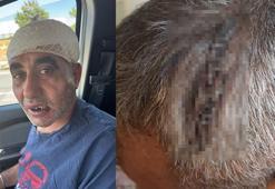 Eğlence mekanında darbedildiği iddiasıyla şikayetçi oldu