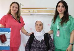 Kalbinin üzerindeki 2 kiloluk kitle ameliyatla çıkarıldı