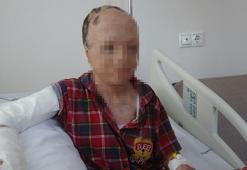 Babası ve 3 kardeşinin öldüğü yangında yaralanan Eymen, artık bir elini kullanabilecek