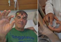 Akciğerinden diş implantı çıktı