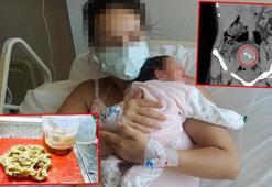 Doğumda unutulduğu 2 yıl sonra ortaya çıkan gazlı bez ihmaline soruşturma izni