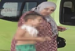 7 yaşındaki Devrim, parfüm sıkıp çakmağı ateşleyince yaralandı