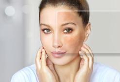 'Güneş ışınlarının prizma etkisi ciltte renk değişimine yol açıyor