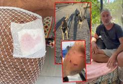 Yürüyüş yaparken köpek saldırısında yaralandı