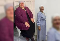 54 yaşındaki Hatice Yıldırım, 1 yılda 35 kilo verdi