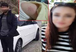 2 çocuğunu teslim etmek istediği eski eşi tarafından darbedildi; o anlar kamerada