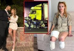 Evlilik yıl dönümünde bacaklarını kaybetti