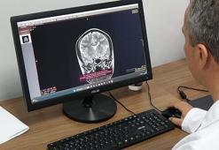 Prof. Dr. Terzi: Her unutkanlık Alzheimer hastalığı değildir