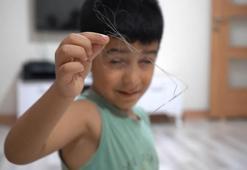 Salatalık yutunca rahatsızlandı; 3 yıl önce vücudunda 18 santimlik kateter unutulduğu ortaya çıktı