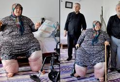 3 yıldır evden çıkamayan fil hastası kadının tekerlekli sandalye sevinci