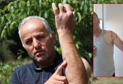 Babası gibi ayı saldırısına uğradı; parmağı koptu