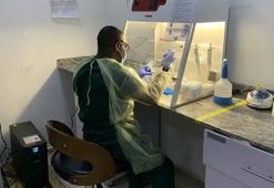 Nijerya’da ‘Lassa ateşi’ salgını: 162 ölü