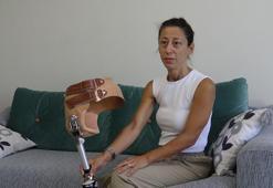 22 yıldır kullandığı protez bacağı ömrünü tamamladı, yenisinin maliyeti 2 milyon TL