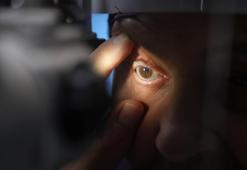 Görme kaybı yaşayan hasta, tedaviyle sağlığına kavuştu