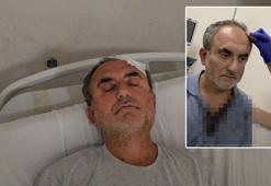 Ekoloji grubu sözcüsüne beton santralinin ortağından darp iddiası