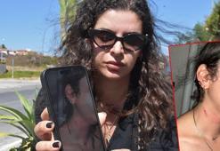 Eski erkek arkadaşı sokak ortasında darbetti