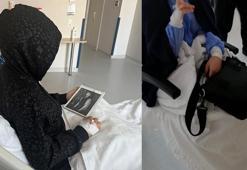 10 yıldır yapay kalp cihazıyla yaşayan Şevval’e nakille yeni hayat