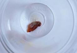 1,5 yıllık öksürüğün nedeni, kabak çekirdeği çıktı