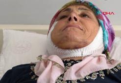 15 yıldır yüz felci olan kadın, ameliyatla sağlığına kavuştu