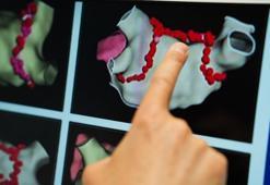 ‘Ablasyon tedavisinde çoğu hasta aynı gün taburcu ediliyor’