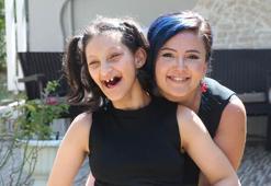 Özel gereksinimli Asya, anestezi altında işitme testi istenince eğitim imkanından yararlanamadı