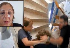 Kedi besleme kavgasında komşusunun burnunu kırdı; o anlar kamerada