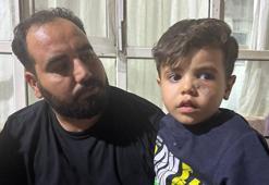 Yorgun mermi, 4 yaşındaki çocuğun gözünün altına isabet etti