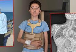 Liseli Eren, 2 seanslık ameliyat ile skolyozdan kurtuldu