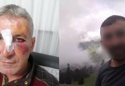 Dairesinin önüne hayvan dışkısı atan komşusundan, bu kez 'yüzüne kapı çarptığı' için şikayetçi oldu