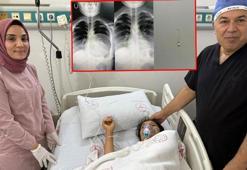 Yuttuğu toplu iğne akciğerine saplanan Bedia, ameliyatla sağlığına kavuştu