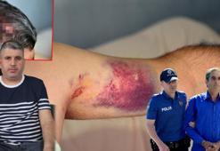 Beyzbol sopasıyla döven dayısı serbest bırakıldı; 'Can güvenliğim kalmadı'