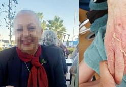 Huzurevinde ölümde, sanık doktor hakkında yakalama kararı