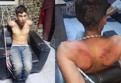 Böcek yedirip, dişlerini kırdılar; savcı 20'şer yıl hapis cezası istedi