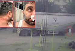 Tamir sırasında TIR'ın sağlam lastiği patladı; 1 yaralı