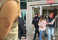 Bakımevinde 3 yaşındaki öğrencisinin kolunu ısıran öğretmen tutuklandı