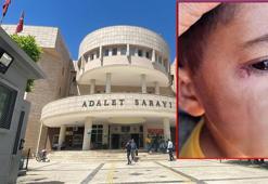 Öğrencinin yüzünde sigara söndüren temizlikçi tutuklandı