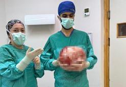 Karnından 8,5 kiloluk kitle çıkarıldı