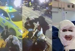 Kadıköy'de kadının üzerine yanıcı madde döküp yaktıktan sonra kaçtı