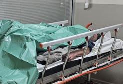 Isınmak için yaktığı ateş kıyafetlerini tutuşturdu, bacakları yandı