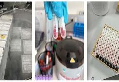 Talasemi hastalığında kan nakli güvenliğini artıran çalışma