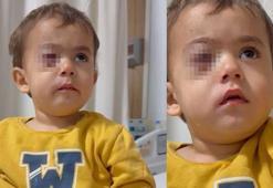 Bursa'da, 2 yaşındaki Alpaslan'ın görme yetisini kaybetmesine neden olan torpil, fırından alınmış