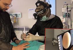 Rize'de 'prematüre retinopatisi' tanı ve tedavisi yapılabilecek