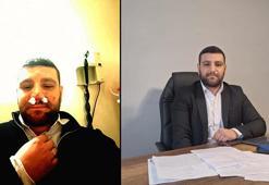 Trafikte yol verme tartışmasında avukatın burnu kırıldı