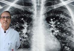 Prof. Dr. Şener'den 'süperenfeksiyon' uyarısı: Dikkat etmek lazım, ücretsiz aşınızı olun