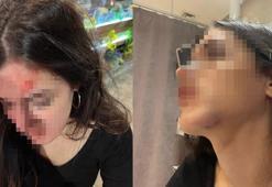 Eski sevgilisi tarafından darbedildiğini iddia edip, fotoğraflarını sosyal medyada paylaştı