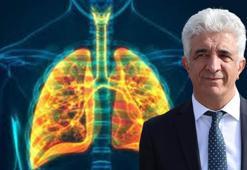 Prof. Dr. Eroğlu: Her yıl Maraş depremi kadar kişi sadece akciğer kanserinden kaybediliyor